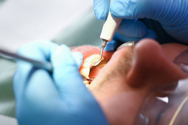 Emergency Dentist for Kids in VA
